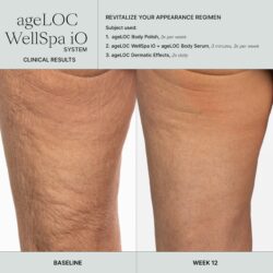 Well Spa IO Erfahrungen - Vorher - Nachher Beine