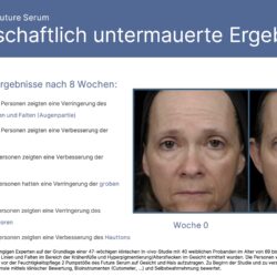 Tru Face Future Serum Vorher Nachher